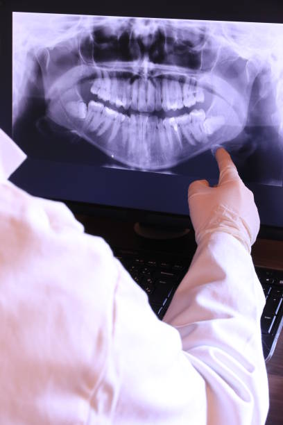 Best Emergency Denture Repair in Forest City, PA